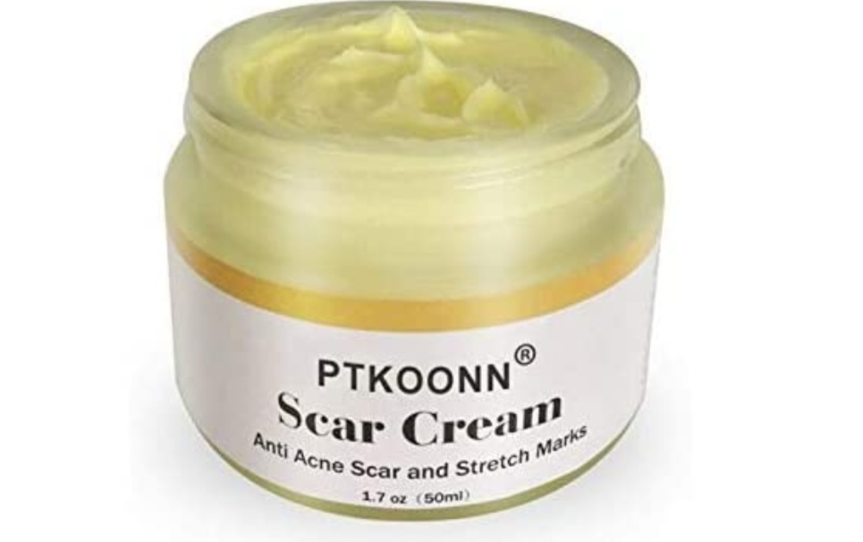 PTKOONN: 50ml Skin Repair Cream: Treatment for Old and New Scars, Stretch Marks, Surgical Scars, Burns, Acne Spots etc... RRP £28